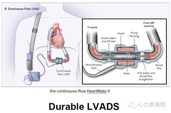 心衰专家张健,中国心衰诊断及治疗指南2018