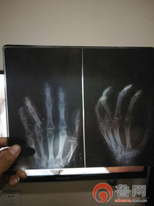 邻里纠纷难以调和原因,邻里纠纷司法不给解决怎么办