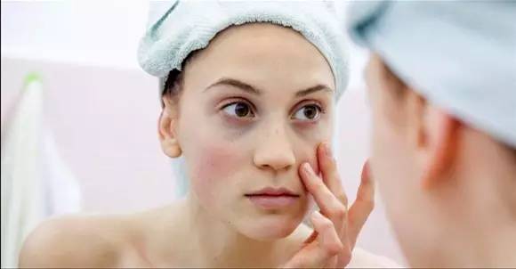 放疗后脸部水肿消肿最快方法,过敏眼睛水肿怎么快速消肿