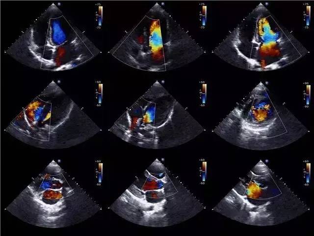 什么是双顶径呢,什么叫做双顶径