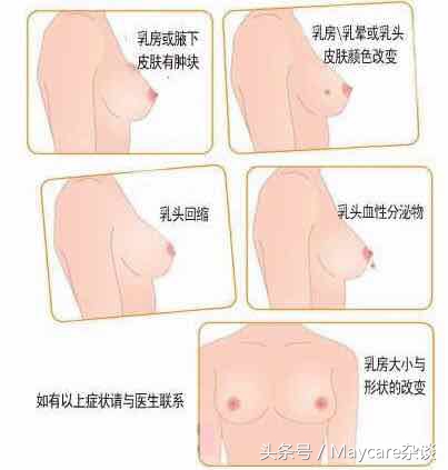 乳腺结节不治是什么结果,猫咪乳腺增生不治会怎么样