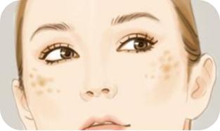 脸上长色斑怎么解决,毛孔粗大色斑多怎么解决