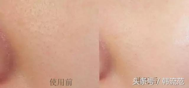 城野医生毛孔收敛水市场分析,城野医生毛孔收敛水一用就爆痘