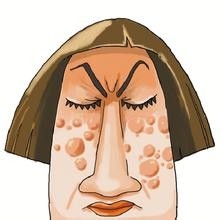 青少年青春痘的治疗小偏方,怎么抗痘痘最有效的方法