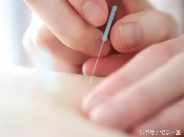 汪慧敏浙江中医药,汪慧敏医师