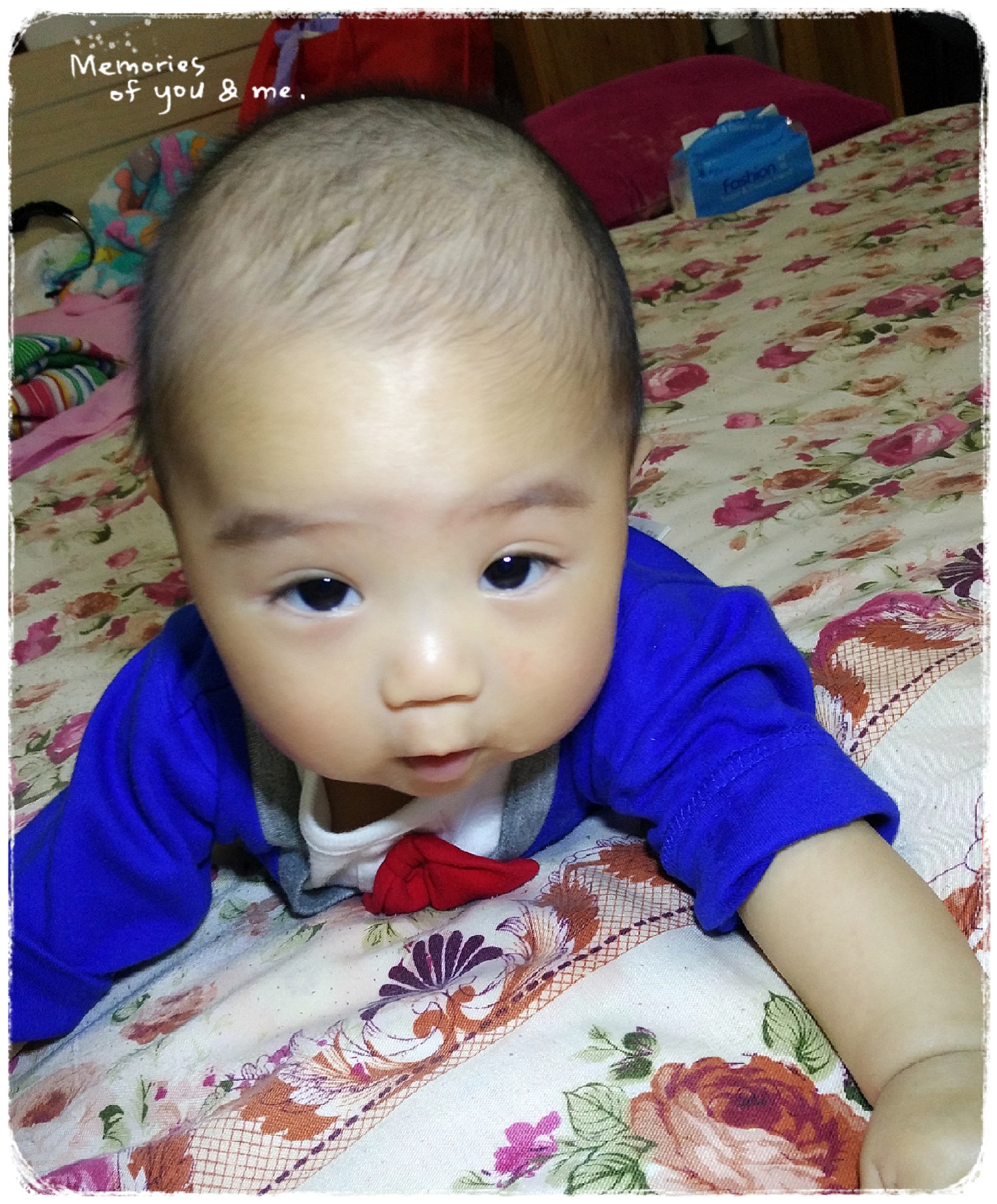 宝宝奶痂几个月才掉,一个月的宝宝长奶痂用什么治疗