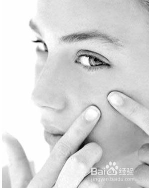 怎样消除青春痘和粉刺最快的方式,如何有效祛除青春痘