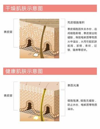 护肤干燥怎么办,冬天脸干燥起皮护肤品推荐
