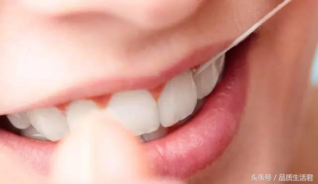 牙线排名第一名不伤牙,16款牙线评测