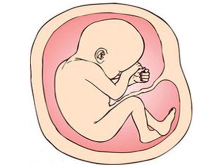 球拍状胎盘的孕妇要注意什么,球拍状胎盘会导致胎盘早剥吗