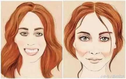 打肉毒素表情会僵硬嘛,打了肉毒素表情僵硬怎么快速解决