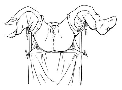 产妇分娩过程就是痛苦并快乐,分娩过程宝宝也辛苦