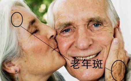 适合女生长期喝的茶祛斑,喝什么的茶祛斑效果最好