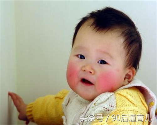 宝宝高原红的脸用什么修复,宝宝一到秋冬季就大红脸