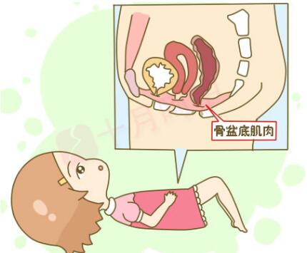 为什么要做产后盆底康复,产后两年了盆底康复还管用吗