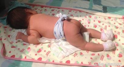 宝宝肺炎住院期间屁股发红,宝宝肺炎而且屁股上身上出红疹子