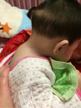 两岁宝宝有点驼背如何纠正,两岁宝宝驼背图片