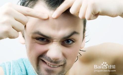 怎样消除青春痘和粉刺最快的方式,如何有效祛除青春痘