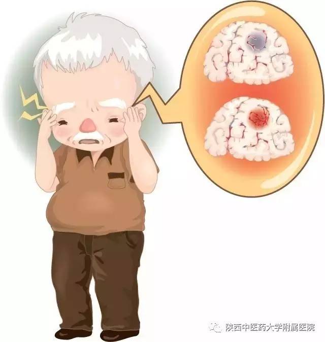 脑出血的家庭康复治疗如何做