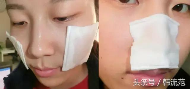 城野医生毛孔收敛水市场分析,城野医生毛孔收敛水一用就爆痘