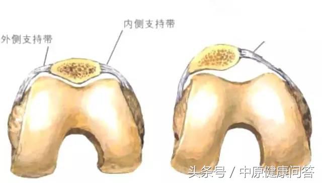 先天性习惯性流产,习惯性流产后期有可能会好吗