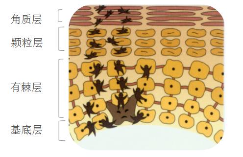 脸上长色斑怎么解决,毛孔粗大色斑多怎么解决