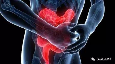 炎症性肠病治疗方案,炎症性肠病治疗方法