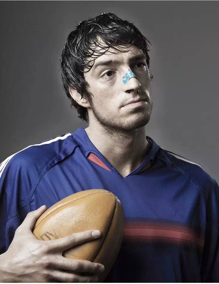 戴了20年的眼镜终于可以摘下来了,戴鼻托掉了的眼镜