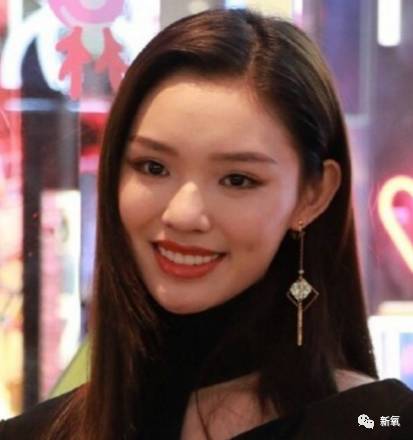 林允整牙却像整容?她是真的又整了啊!