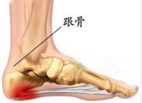 脚后跟摸着不疼踩着就疼是啥原因,走路多脚后跟疼是什么原因引起的