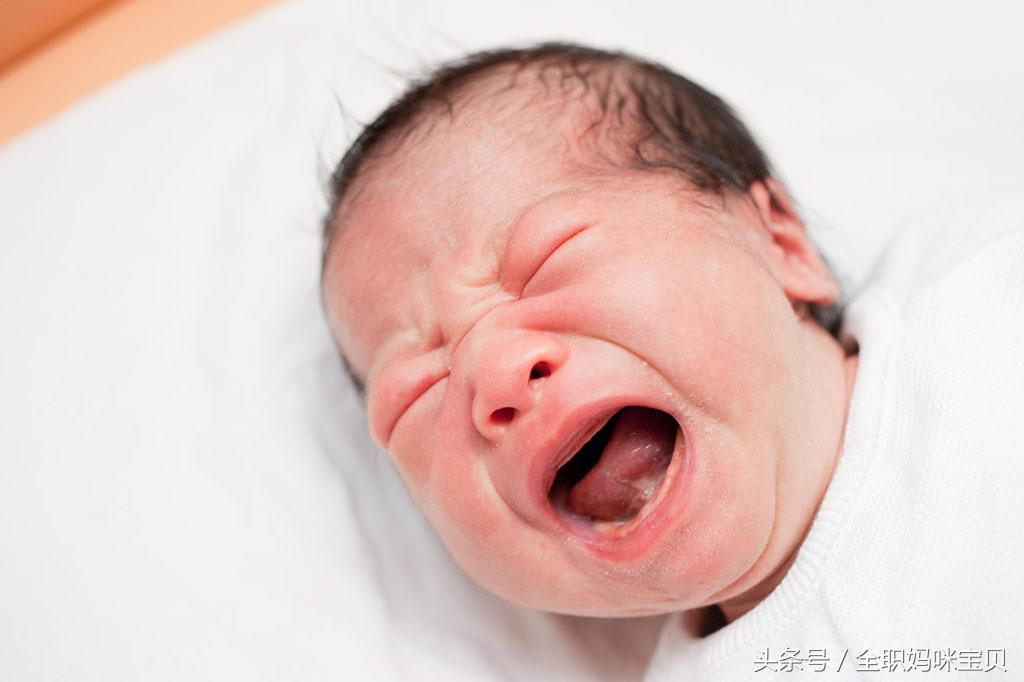 婴儿肚脐一直出血怎么回事,22天的宝宝肚脐出血是怎么回事