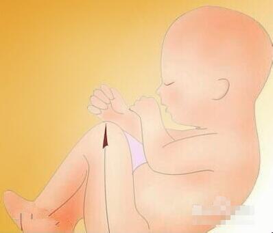 b超单怎么看单双,如何看懂b超单图片