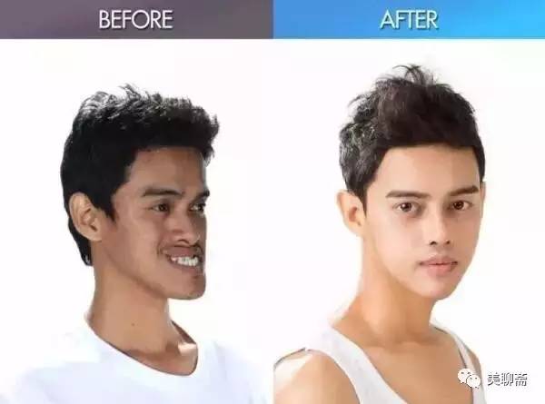 揭秘韩国整容术发达的原因,韩国整容业发达背后的原因