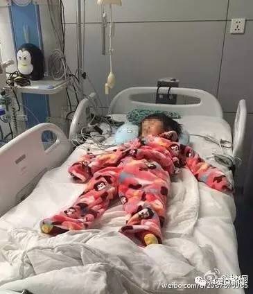 七岁女孩近视散光,9岁女童近视散光