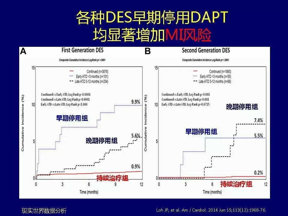 许锋︱冠心病双联抗血小板治疗