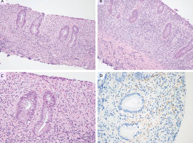 踏血寻梅的由来,踏血寻梅内情是什么