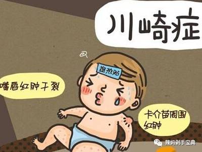 得过川崎病小孩10个月不会发烧吗 (小孩川崎病c蛋白25为什么还发烧)