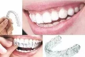 腺样体牙齿矫正最佳年龄,地包天牙齿矫正最佳年龄