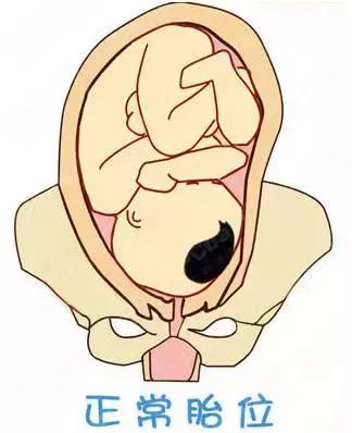 宝宝出生怎么睡觉姿势好,宝宝出生的姿势