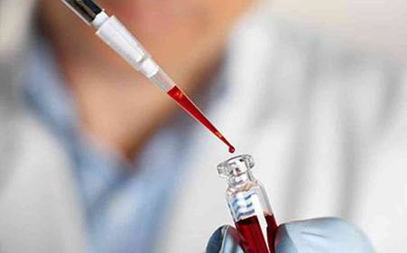 血癌不造血,血癌什么情况下不会用化疗