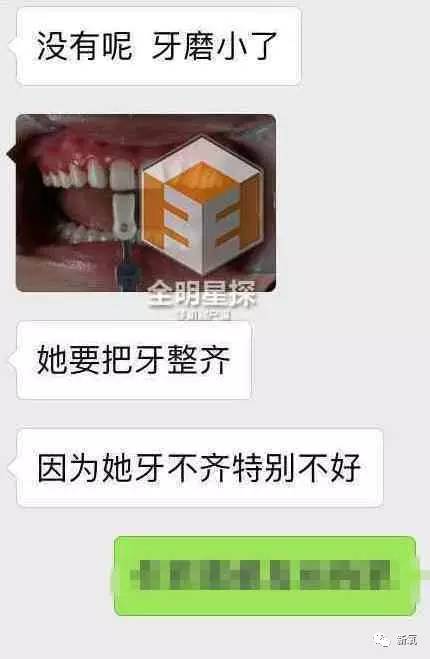 林允整牙却像整容?她是真的又整了啊!