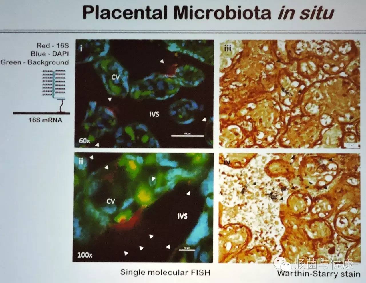 如何确定胎盘有活性,胎盘不存在微生物吗