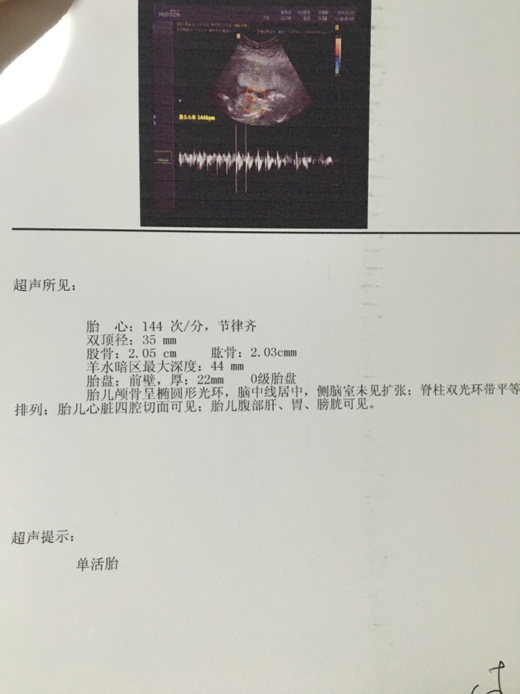 16W+3B超女翻男，二胎妈妈开扒两胎的各种症状