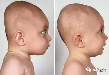 宝宝头型睡偏头了怎么调整过来,婴儿睡觉偏头怎么纠正图文