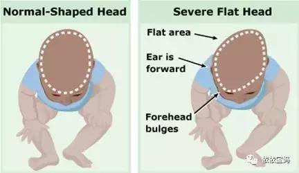 宝宝头型睡偏头了怎么调整过来,婴儿睡觉偏头怎么纠正图文