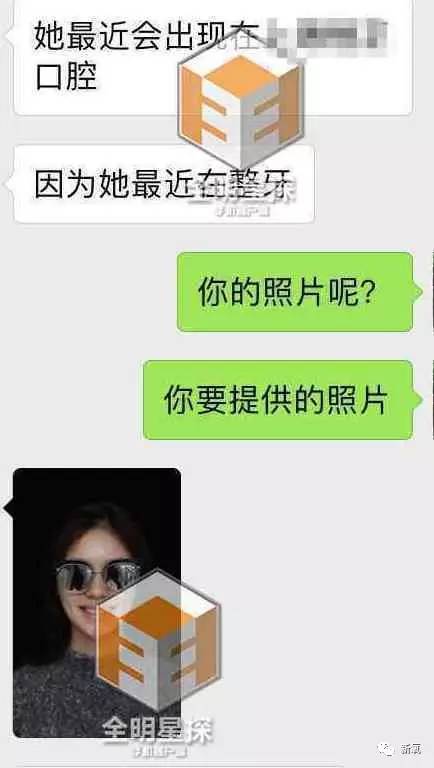 林允整牙却像整容?她是真的又整了啊!