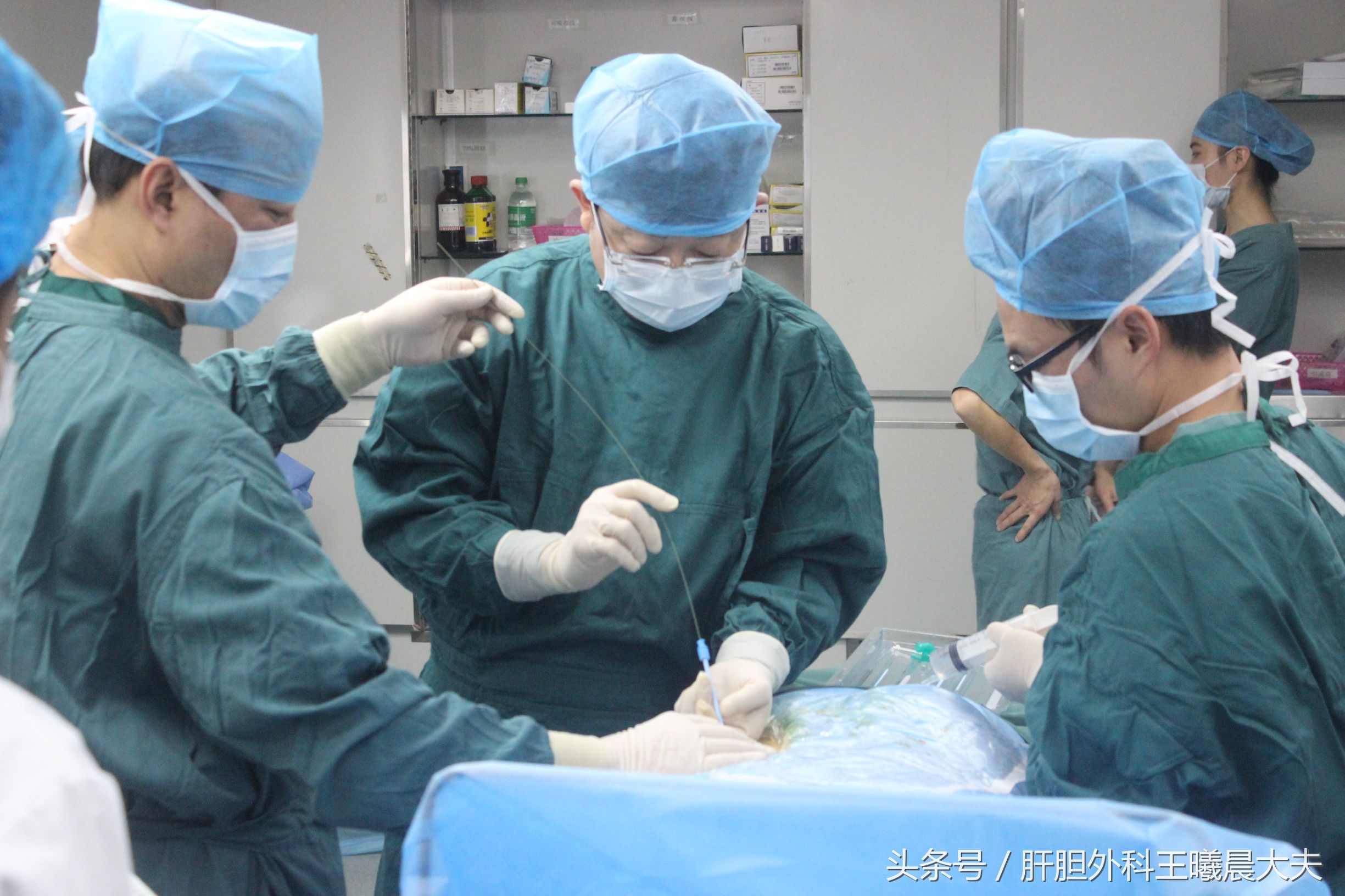 “超微创”：笔芯粗细的通道取出结石