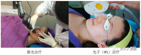 黑脸娃娃收缩毛孔,收缩毛孔黑脸娃娃