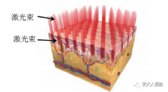 黑脸娃娃收缩毛孔,收缩毛孔黑脸娃娃