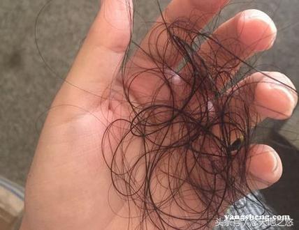 头发末端有白色小点是不是发根,掉落的头发发根有小白点正常吗